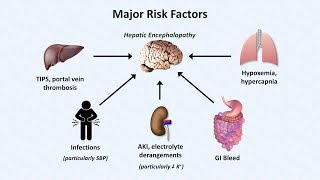 Hepatic Encephalopathy [upl. by Balf]