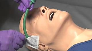 Nasopharyngeal Airway NPA Insertion [upl. by Agate]