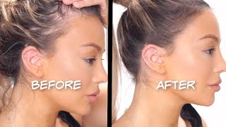 HOW TO FAKE A PERFECT HAIRLINE AND COVER BALD SPOTS  Dilan Sabah [upl. by Matthiew]