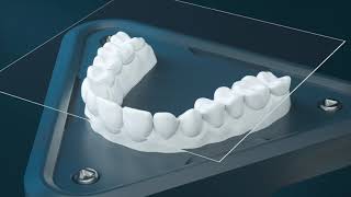 The Next Generation in Clear Aligners  Reveal® [upl. by Ardnoik]