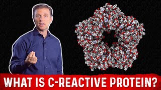 What is CReactive Protein amp How to Lower it – Dr Berg [upl. by Odrarebe]