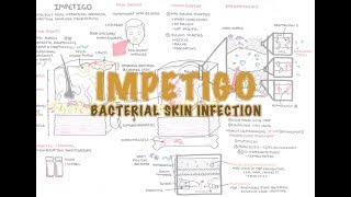 Impetigo Bacterial Skin Infection  Overview Clinical Presentation Pathophysiology Treatment [upl. by Sevy]