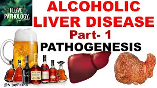 ALCOHOLIC LIVER DISEASE Part 1 Pathogenesis [upl. by Ybloc550]