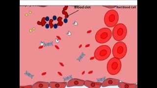 Staphylocccus aureus virulence factors [upl. by Atiras788]