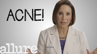 What is Acne and How Do I Get Rid of it Forever  Allure [upl. by Negroj]