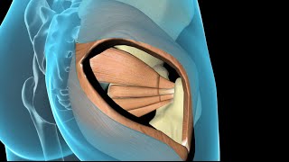 Artroplastia Total do Quadril [upl. by Ientruoc150]