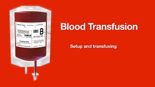 Blood transfusion Setup and transfusion [upl. by Lainey]