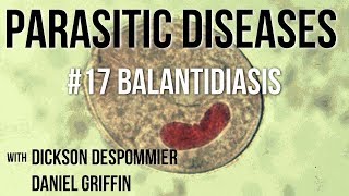 Parasitic Diseases Lectures 17 Balantidiasis [upl. by Nepean150]