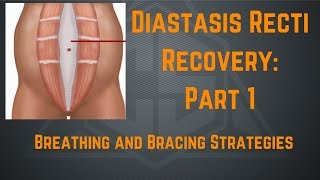 Diastasis Recti Recovery Part 1 Breathing and Bracing Strategies [upl. by Helfant]