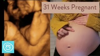 31 Weeks Pregnant What You Need To Know  Channel Mum [upl. by Emixam]