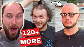 BALDING Men BeforeAfter Going FULL BALD 1 [upl. by Nedrud]