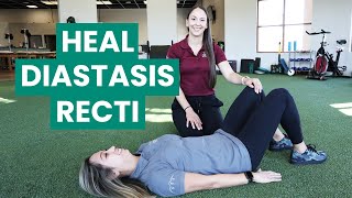 Exercises to Fix Your Diastasis Recti  Physical Therapy [upl. by Yvor]