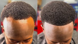 HOW TO FIX A BALDING RECEDING HAIRLINE  PERFECT HAIRCUT FIX [upl. by Johnette]